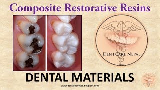 Composite Restorative Resins  Dental Materials [upl. by Hedges165]