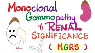 Monoclonal Gammopathy of Renal Significance MGRS  Plasma Cell Disorder  Hematology  Oncology [upl. by Karita484]