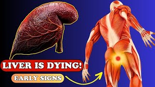 LIVER is DYING 12 Weird Signs of LIVER DAMAGE  Health care [upl. by Odnam]