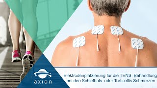 Torticollis oder Schiefhals  Elektrodenplatzierung für TENS  axion [upl. by Ainotal]