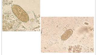 Capillaria philippinensis Year1 Sem2 [upl. by Steel]