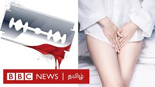 பெண் பிறப்புறுப்பு சிதைப்பு என்றால் என்ன  genital mutilation  Tamil [upl. by Trebleht]