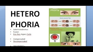 Ophthalmology 357 HeteroPhoria Latent Strabismus Squint Compensation DeCompensation [upl. by Silliw777]