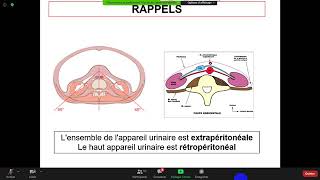 Pr Rahmouni  Néphrologie Insuffisance rénale aigue [upl. by Kerk]