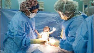 😱Cesarean delivery Kaisey hota hai  Csection operation Ke baad shortstrendingviral [upl. by Longwood919]