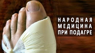 Народная медицина в лечении подагры [upl. by Notgnihsaw]