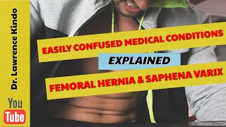 Easily Confused Medical Conditions – Femoral Hernia and Saphena Varix [upl. by Innad168]