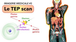 IMAGERIE MEDICALE 5  Le TEP scan [upl. by Nycila]