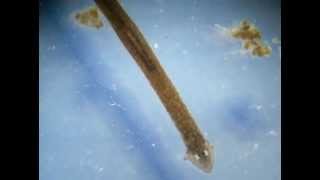 Planaria Phylum Platyhelminthes [upl. by Rutter]