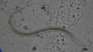 Nematodo nº 3 F Nematoda [upl. by Langbehn]