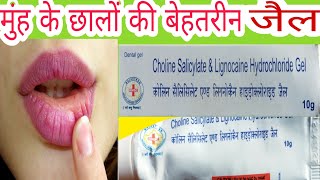 Choline Salicylate amp Lignocaine Hydrochloride Uses in Hindi [upl. by Anatol]