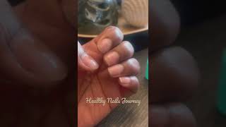 How To Grow Your Nails Fast  Nail Growth In One Week [upl. by Strohbehn]