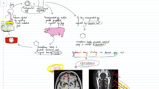 Taenia solium amp saginata Life cycle Neurocysticercosis Parasitology  neetpg inicet [upl. by Jovita18]