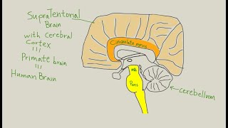 How to rehab TBI Traumatic Brain Injury [upl. by Lourie]