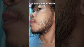 Kirkland Minoxidil Beard Journey 19 WEEK TRANSFORMATION [upl. by Ellek]