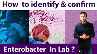 How to identify amp Confirm Enterobacter Bacteria at Lab [upl. by Eiralih]