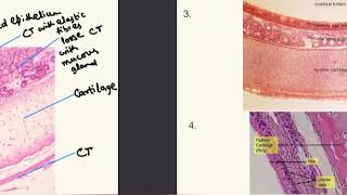 AS Level Biology 9700  Transverse sections of trachea and lungs made extremely easy [upl. by Irish576]