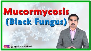 Mucormycosis  Black fungus disease in Covid 19 Causes Signs amp Symptoms Diagnosis and Treatment [upl. by Adlecirg550]