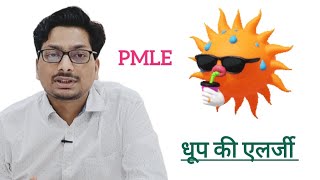 धूप की एलर्जी  Polymorphous light Eruption  Sunlight Allergy  PMLE Ultraviolet किरणों की एलर्जी [upl. by Dav]