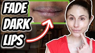 HOW TO FADE DARK LIPS  Dr Dray [upl. by Nortna]