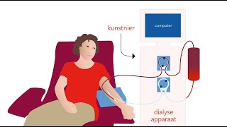 Hemodialyse bloeddialyse [upl. by Wilhelmina]