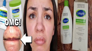 quotCetaphil Moisturizing Lotion Review  For Dry Oily amp Sensitive Skin  Best Skincare Productquot [upl. by Mauro]