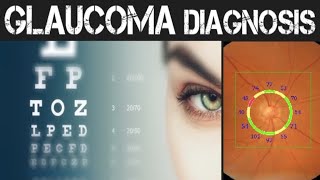 How Glaucoma is Diagnosed amp Managed [upl. by Noiro1]