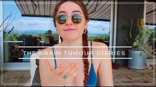 My Brain Cancer Chemotherapy and Radiotherapy Update [upl. by Nash329]