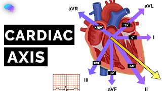 Cardiac Axis Explained  ECG  EKG  OSCE Guide  UKMLA  CPSA [upl. by Akaya]