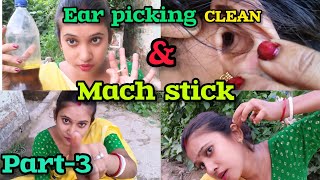 EAR PICKING CLEAN CHALLENGEEAR PICKING CLEAN MUSTARD OIL WITH MACH STICKPART3requestvideoCHALLE [upl. by Eilrebmik]