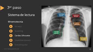 Tutorial Radiografía de Torax [upl. by Ehsrop]