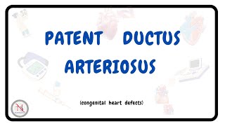 PATENT DUCTUS ARTERIOSUS  Causes  Symptoms  Pathophysiology  Treatment  The Nurses Station [upl. by Strep]