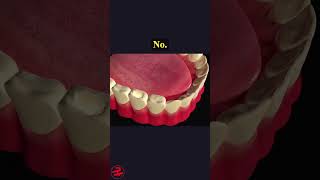 Tooth Cavity Filling Procedure health wellness shorts [upl. by Chelsie761]