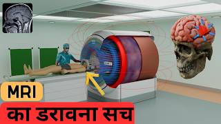 How Does An MRI Machine Work Step By Step [upl. by Homovec]