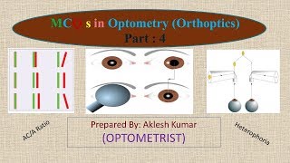 MCQ in Optometry Orthoptics part 4 [upl. by Melise176]