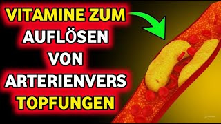 Entfernen Sie Arterienplaques auf natürliche Weise mit 6 kraftvollen Vitaminen [upl. by Anagnos]