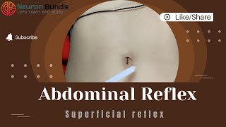 Mastering Superficial Abdominal reflex  Normal amp Absent reflex umnlesion reflexes [upl. by Yllrebmik925]