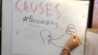 Pericardial Effusion [upl. by Airtened]