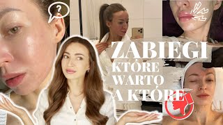 💉Zabiegi na twarz  które WARTO a które to strata pieniędzy💸 Kosmetologia i medycyna estetyczna [upl. by Lubbock639]