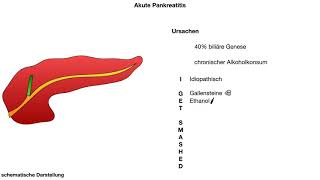 akute Pankreatitis  Ursachen wwwclipdocsde [upl. by Agnella]