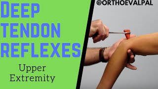 Deep Tendon Reflexes of the Upper Extremities [upl. by Haimes]