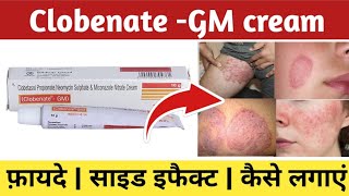 Clobenate gm cream ke fayde  Clobenate gm cream kis kaam aati hai  Clobenate gm cream uses [upl. by Ottillia]