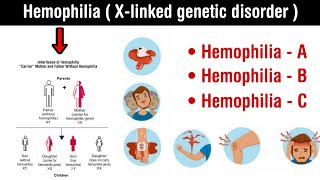 Hemophilia  Xlinked genetic disorder l types and symptoms of hemophilia in Hindi [upl. by Krishnah]