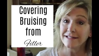 Covering Bruising from Filler OVER 50 [upl. by Hutchison]