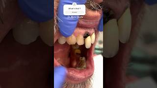 Oh No Oh No … TikTok dentist viral youtubeshorts tiktok fyp smile shorts shortvideodentist [upl. by Onaicilef]