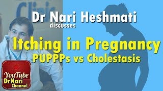 Itching in Pregnancy PUPPPs vs Cholestasis of Pregnancy Discussed by Dr Nari Heshmati [upl. by Evelina]