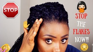 HOW TO PREVENT GEL FROM FLAKING ON NATURAL HAIR  TIPS AND TRICKS [upl. by Gerius]