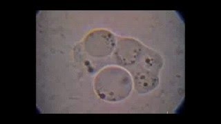 Trichomonas hominis con doble intento de fagocitosis de Blastocystis por un citostoma elástico [upl. by Ellie794]