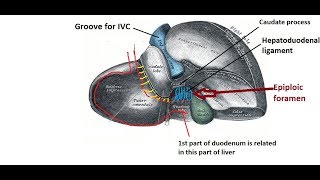 Epiploic foramen  easy and brief description [upl. by Airetnuhs]