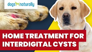 Home Treatment For Interdigital Cysts [upl. by Fernande]